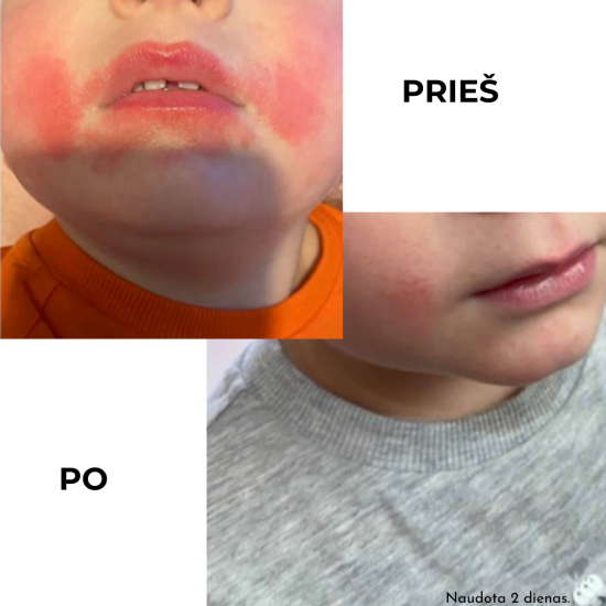 KOKOSO BABY apsauginis pieštukas su kokosų aliejumi visai šeimai, Be kvapo