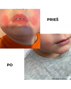 KOKOSO BABY apsauginis pieštukas su kokosų aliejumi visai šeimai, Be kvapo