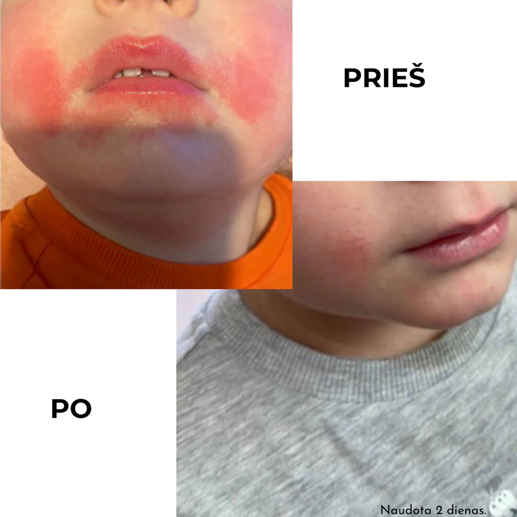 KOKOSO BABY apsauginis pieštukas su kokosų aliejumi visai šeimai, Be kvapo